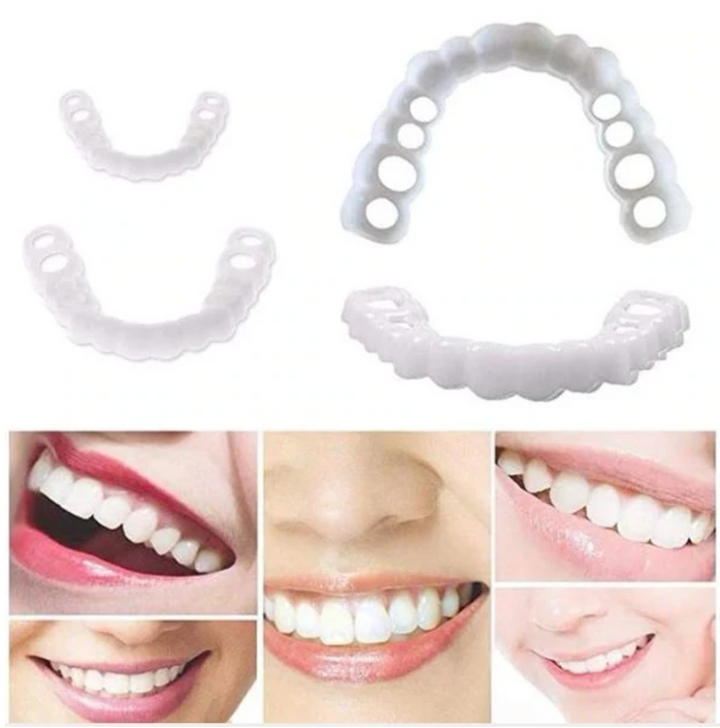 Skanto | HappySmile Facet sett | Gjenbrukbare øvre og nedre fasetter for et strålende smil