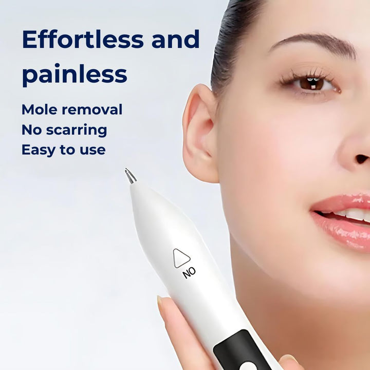 DermaGlow | Mole Removal Pen – Ikke-invasiv plasma – Trådløs & oppladbar – Hjemmebehandling for hudflikker & fregner Skanto