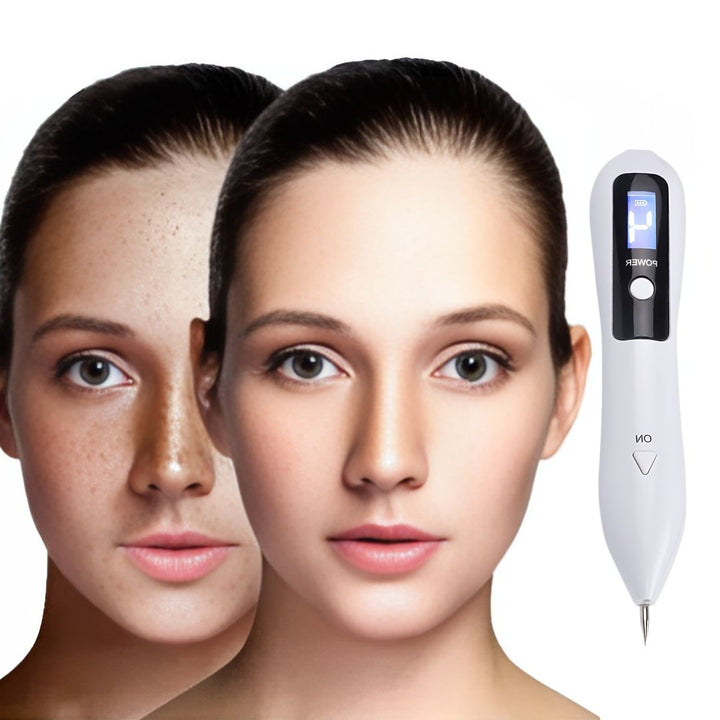 ClearSkinPro Laser Plasma Penn - Ikke-invasiv | for fjerning av fregner, hudtagger, flekker, føflekker og tatoveringer hjemme Skanto