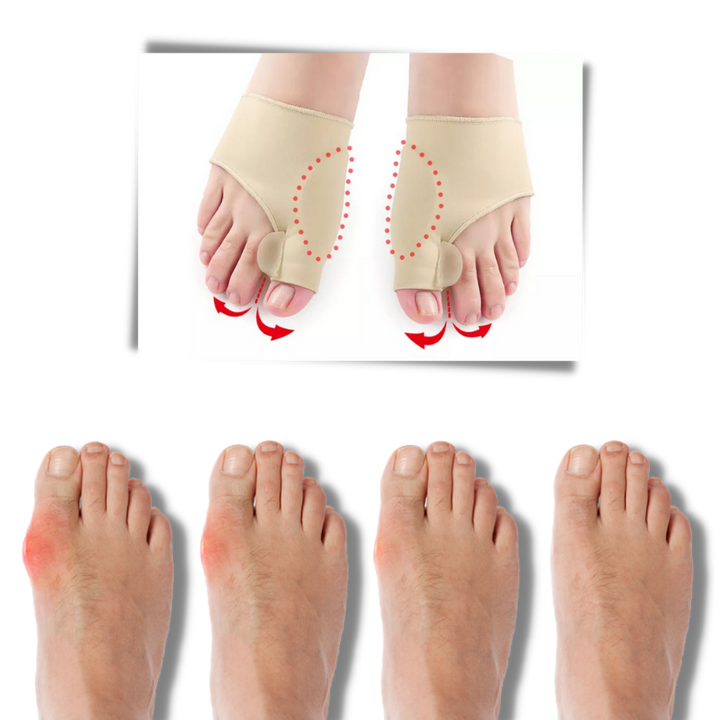 Gel hallux valgus justering