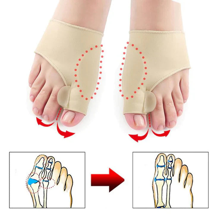 Skanto | Hallux-Valgus-Korreksjonsbeskyttelse (1 par)