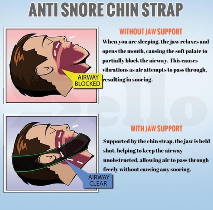 Skanto | Anti Snore Stop Snoring Kinnrem Belte