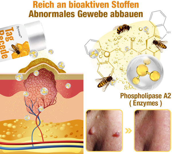 TagRecede Bee Gift Spray | Naturlig Hudperfeksjon | Skanto
