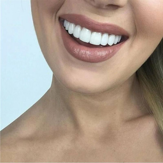 PerfectSnap | Alltid det perfekte smilet