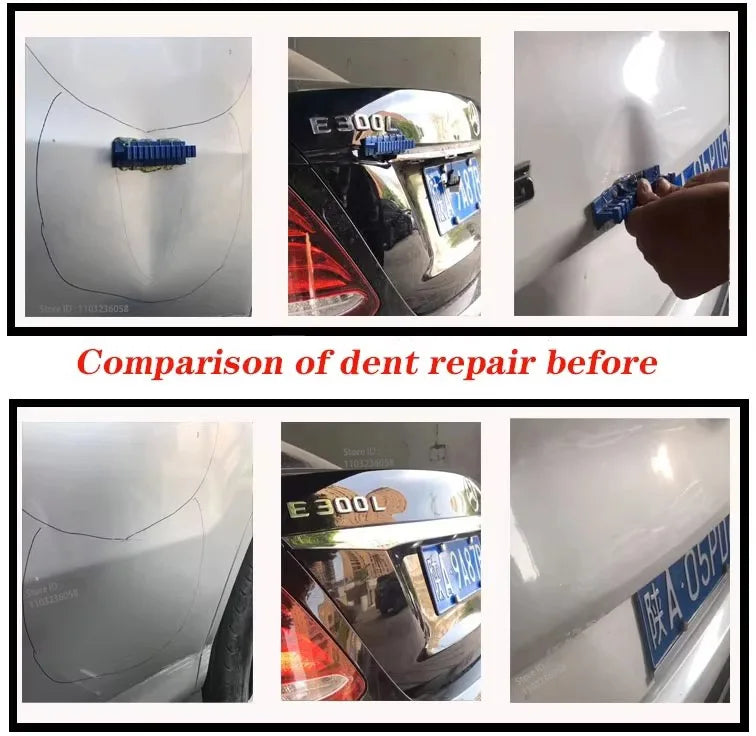 Dent Repair Tool Set Bil Denter | Skanto