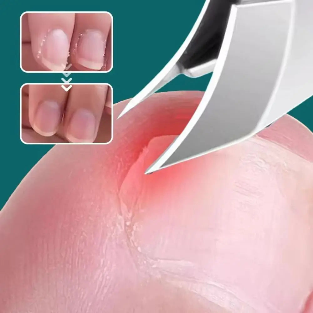 Skanto | Curved Edge Sharp Ingroddnegl Klipper