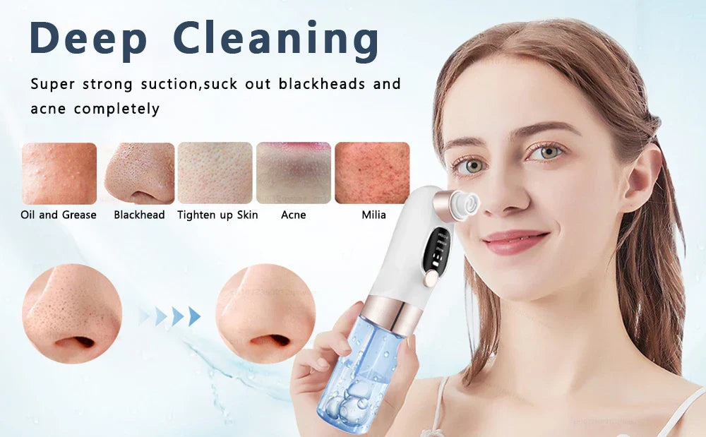 Skanto | Acne Black Head Deep Clean Removal