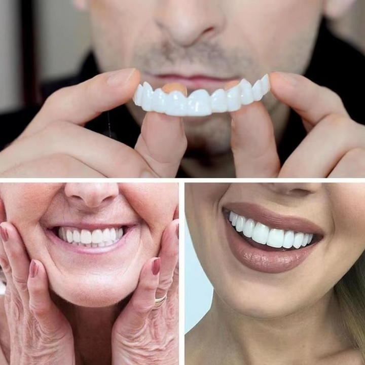 Skanto | 2PCS Snap-On Veneer Proteser for Menn og Kvinner, Umiddelbar Midlertidig Tannbeskyttelse for et Selvsikkert Smil