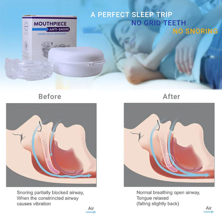 Skanto | Anti-Snore Munnstykke
