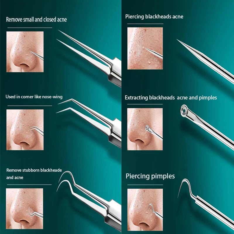 Skanto | Clear Skin Blackhead Remover Care Kit