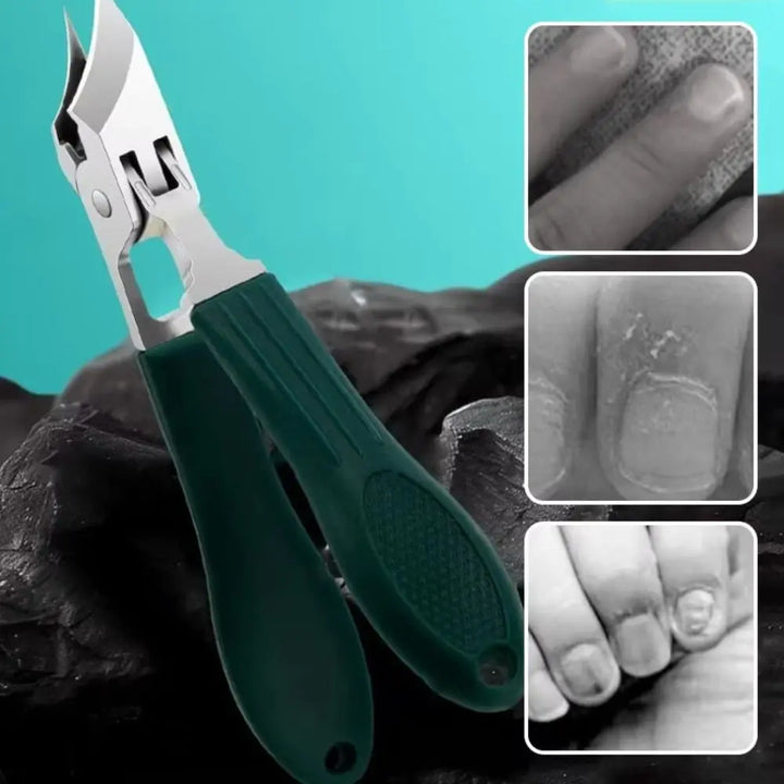 Skanto | Curved Edge Sharp Ingroddnegl Klipper