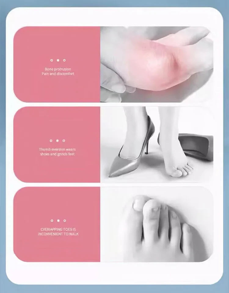 Skanto | Silikon Hallux Valgus Bunion Korrigerer