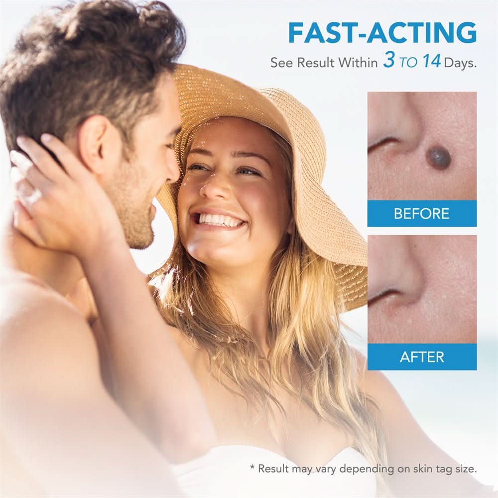 Skanto | DERMASWIFT – Hudflekkfjerner for Vorter & Hudflikter