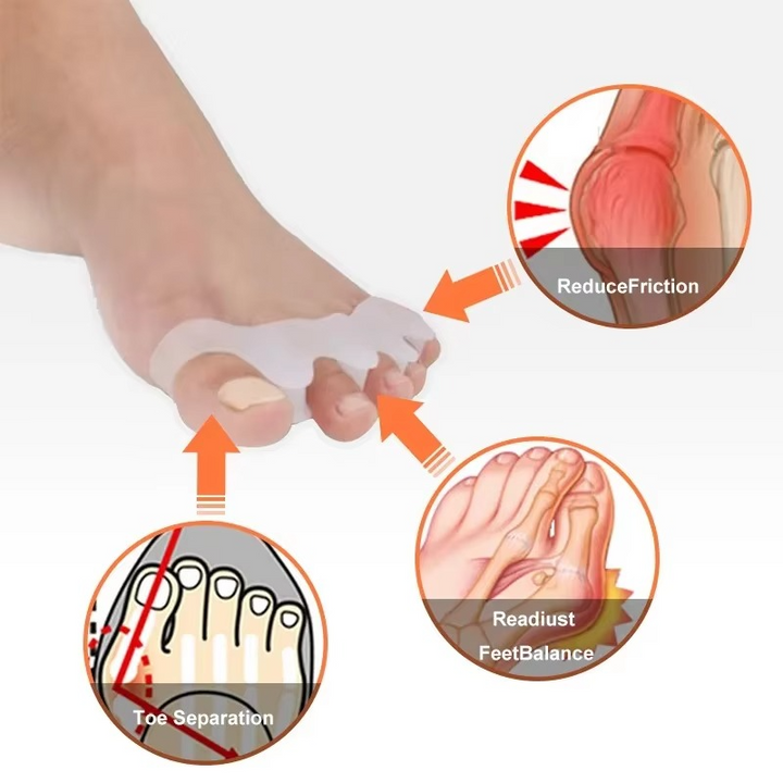Skanto | Myke silikon tåseparatorer for hallux valgus lindring og justering, 1 par