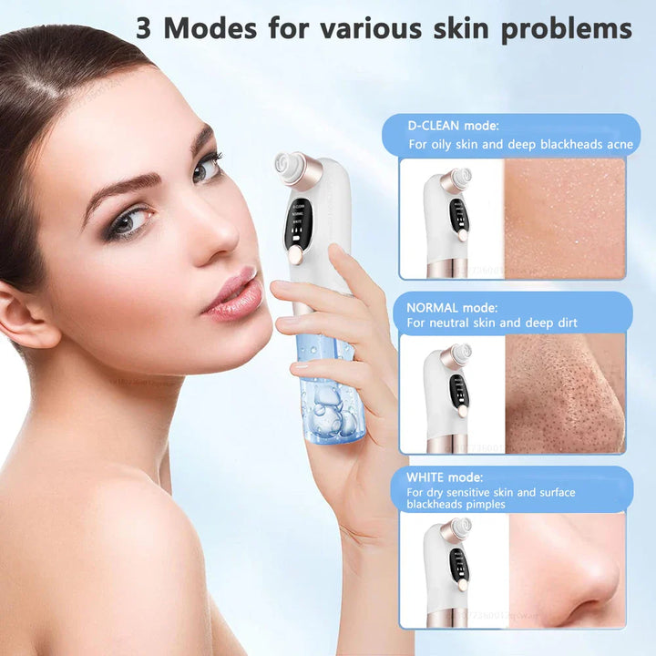 Skanto | Acne Black Head Deep Clean Removal