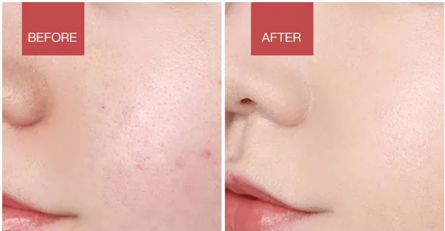 Norvo | Elektrisk ansiktsrens med LED-lys og 42 °C varme teknologi | Silikon hudpleieapparat med lydvibrasjon