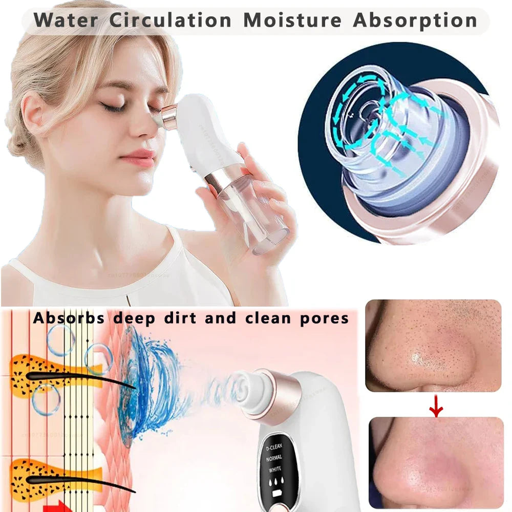 Skanto | Acne Black Head Deep Clean Removal