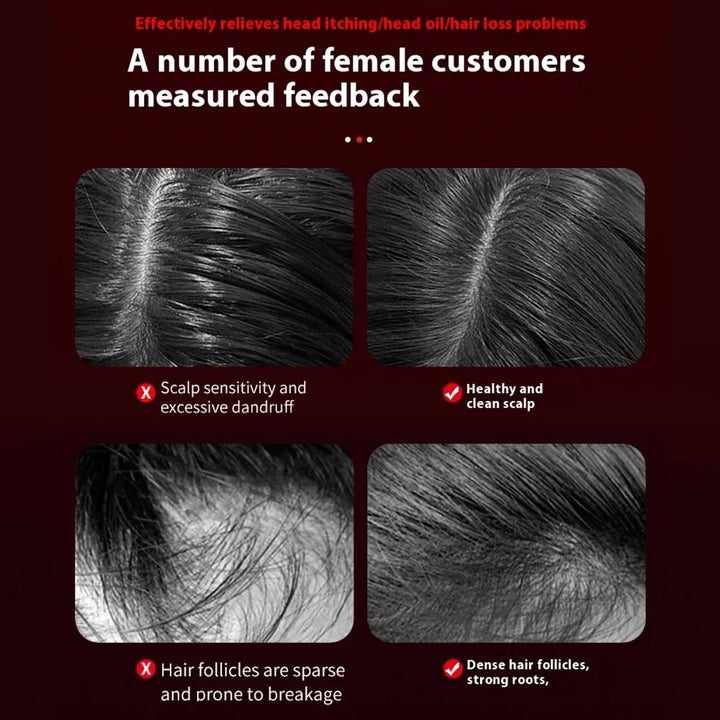 Skanto | Massasje For Hårvekst – Styrk Håret Ditt Og Slapp Av Hodebunnen
