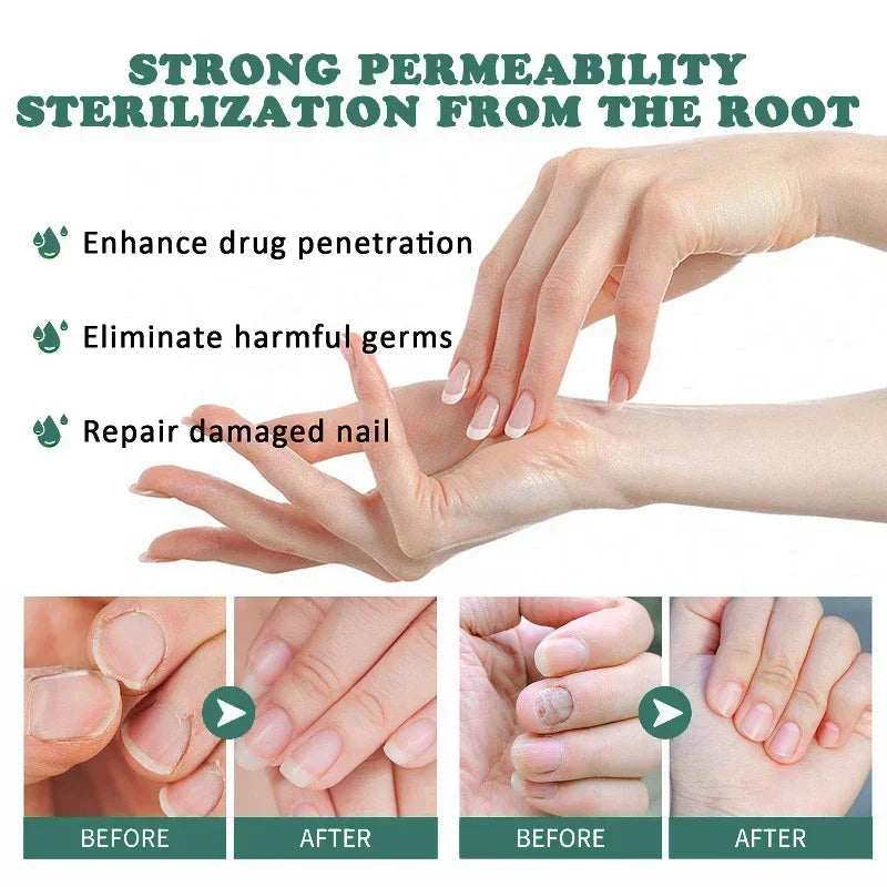 Skanto | Soppforsvar Serum