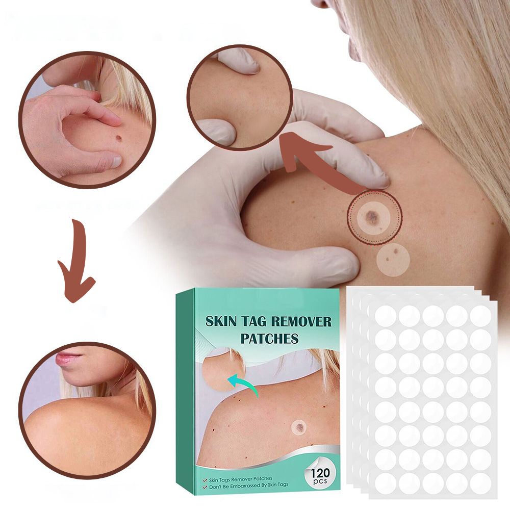 SkinClear - Patches for fjerning av flekker og vorter Skanto