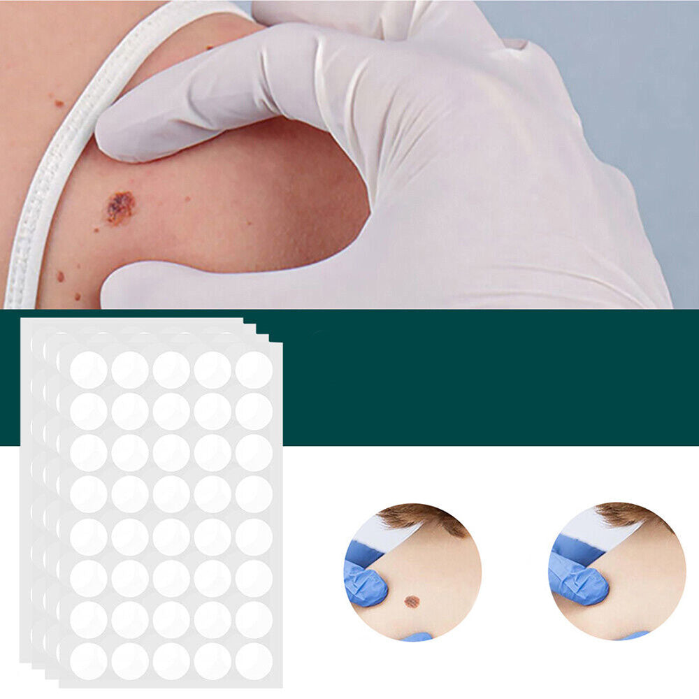 SkinClear - Patches for fjerning av flekker og vorter Skanto