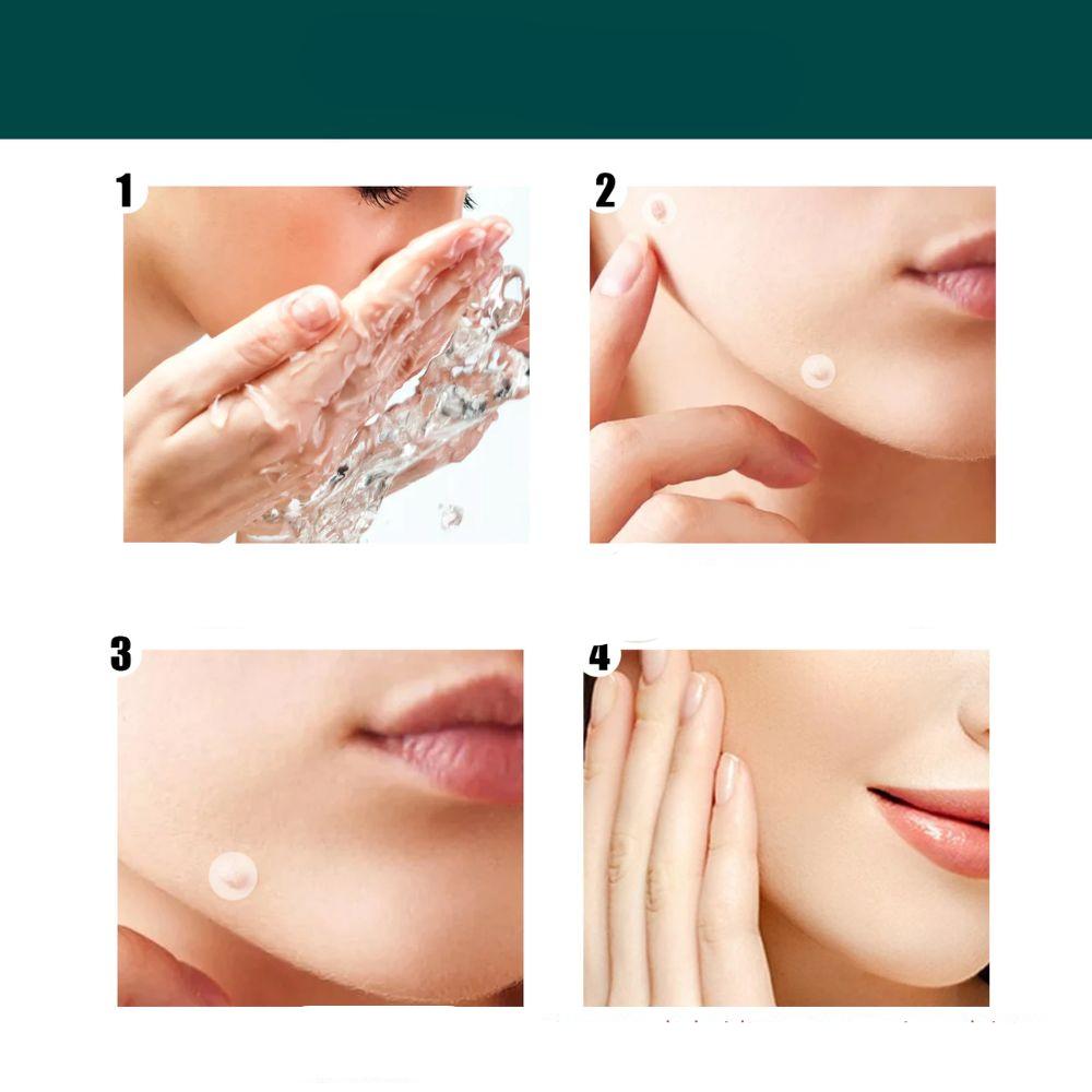 Skanto | SkinClear - Plaster for the removal of spots and warts