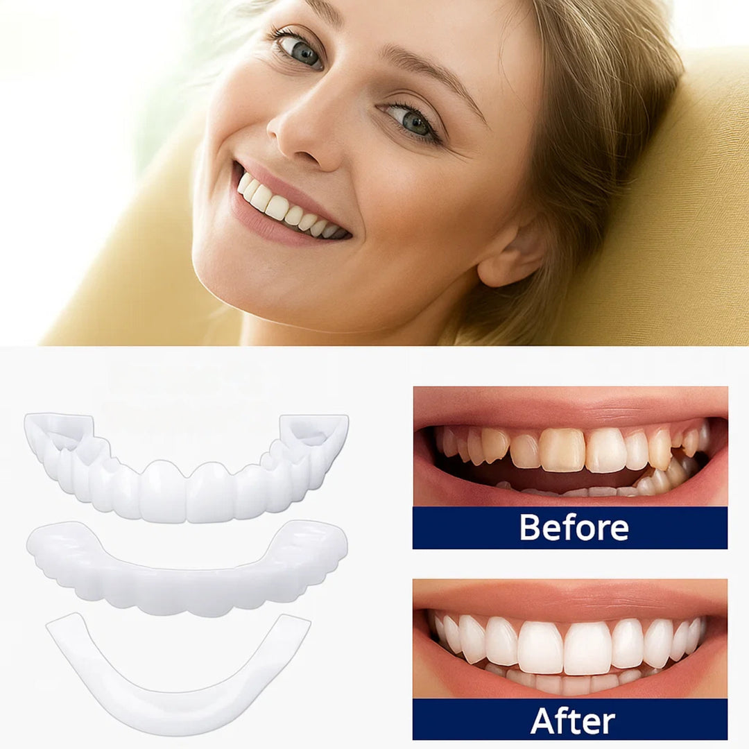 SmileEase | Clip-On Veneers – Umiddelbar Smilforbedring – Ultratynn Design – Ideell for voksne som søker rimelige tannhelse-løsninger Skanto