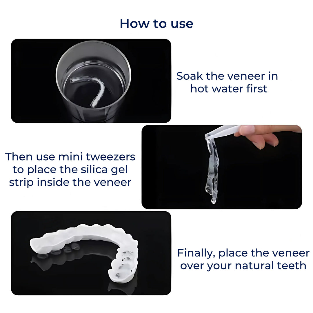 SmileEase | Clip-On Veneers – Umiddelbar Smilforbedring – Ultratynn Design – Ideell for voksne som søker rimelige tannhelse-løsninger Skanto