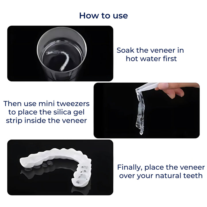 SmileEase | Clip-On Veneers – Umiddelbar Smilforbedring – Ultratynn Design – Ideell for voksne som søker rimelige tannhelse-løsninger Skanto