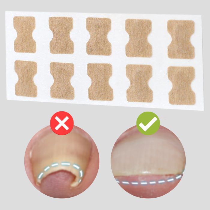 Skanto | ProFlexiPatches — Painless naturlige negler som du igjen viser stolt