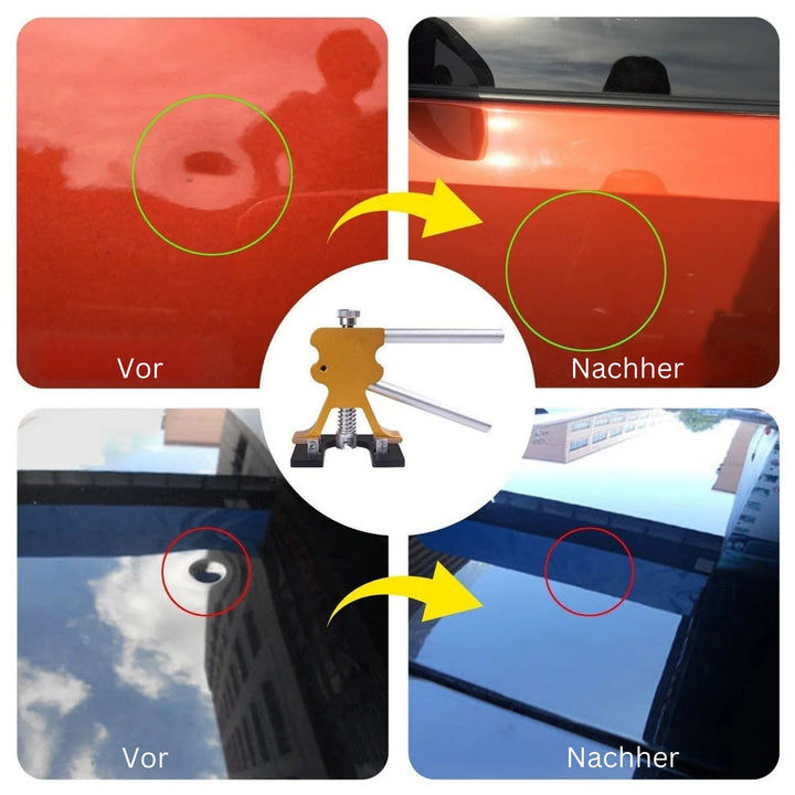 DeukFix Reparasjonssett – Bilbulker Fjerning Uten Lakk Damage | Skanto