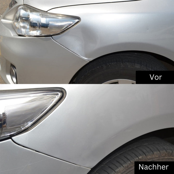 DeukFix Reparasjonssett – Bilbulker Fjerning Uten Lakk Damage | Skanto