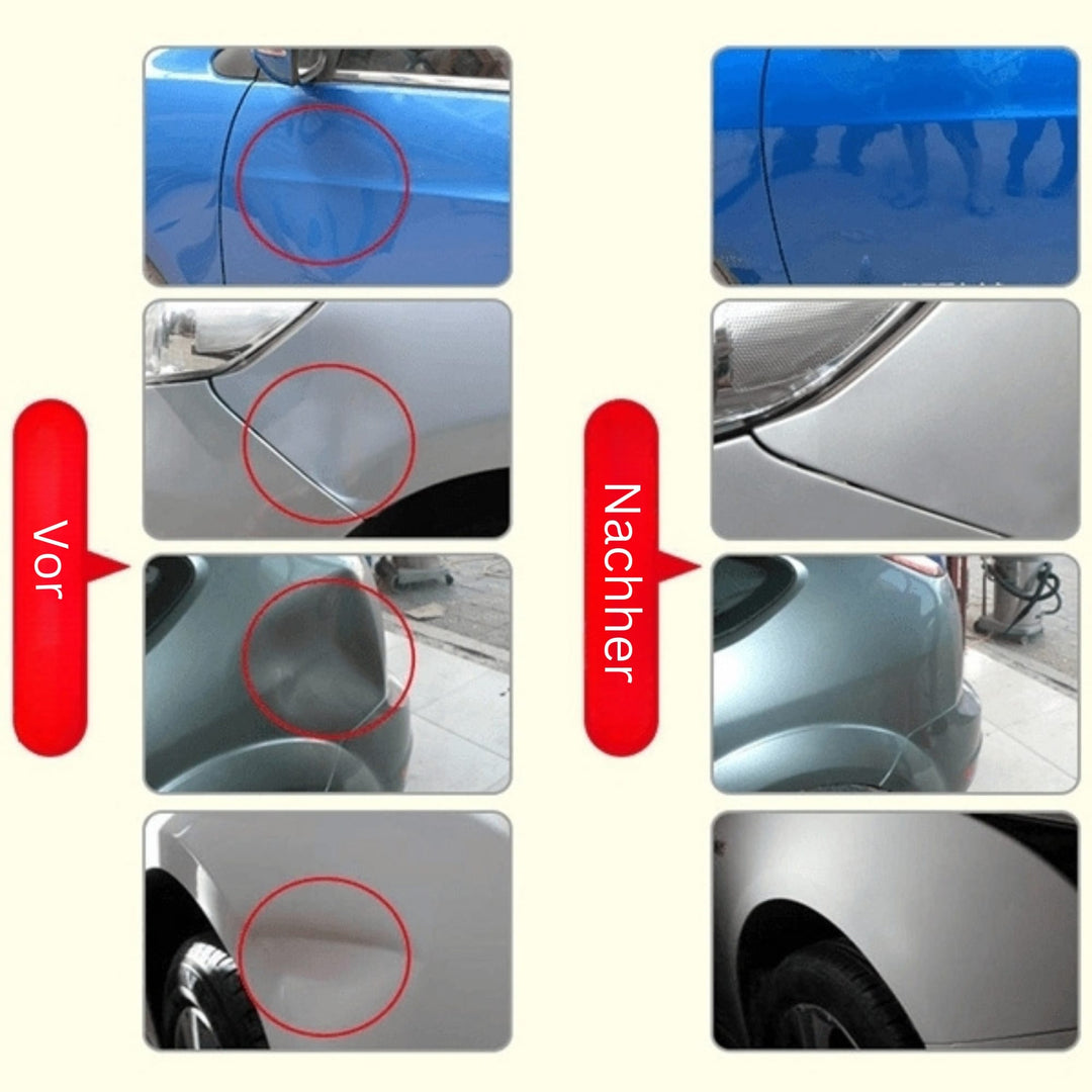 DeukFix Reparasjonssett – Bilbulker Fjerning Uten Lakk Damage | Skanto
