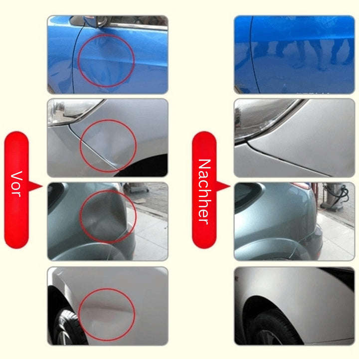 DeukFix Reparasjonssett – Bilbulker Fjerning Uten Lakk Damage | Skanto