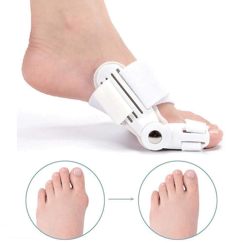 Skanto | Hallux Valgus Korrigerende Skinne – Justerbar Ortose for Hallux Valgus Lindring