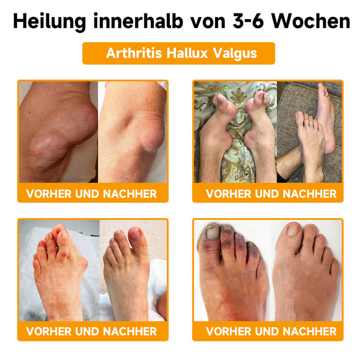 Bienen-Vital-Creme | Rask smertelindring | Skanto