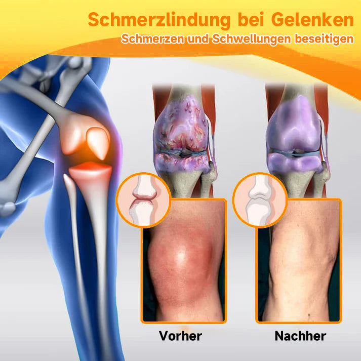 Bienen-Vital-Creme | Rask smertelindring | Skanto