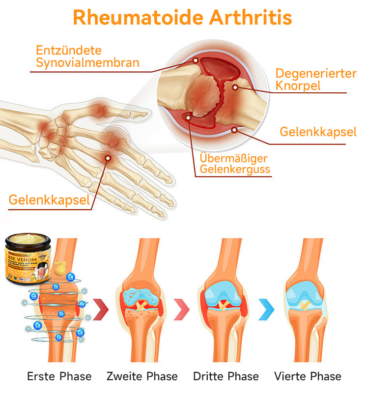 Bienen-Vital-Creme | Rask smertelindring | Skanto