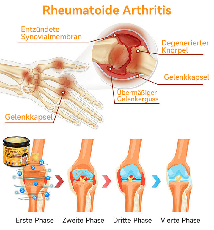 Bienen-Vital-Creme | Rask smertelindring | Skanto
