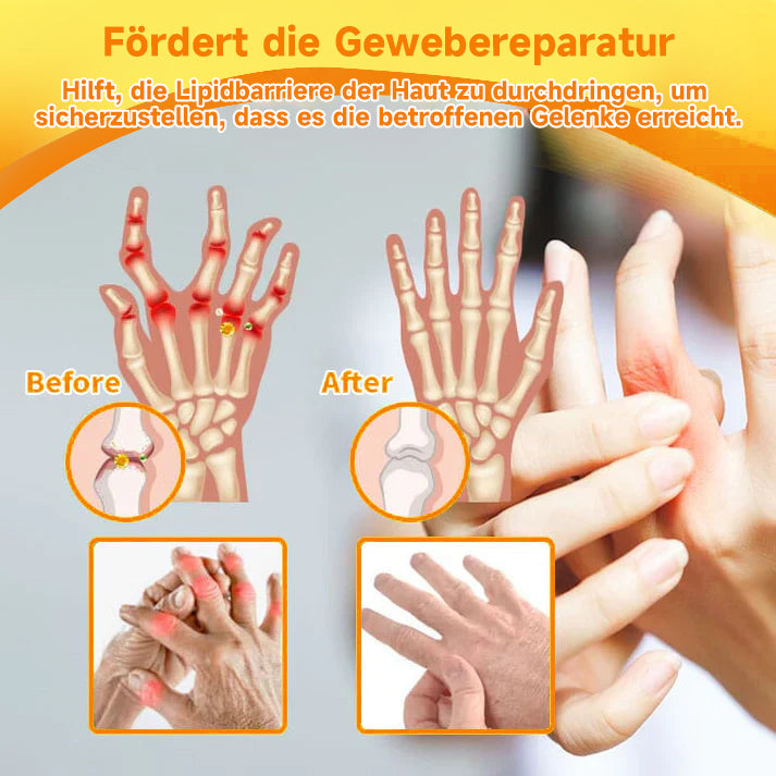 Bienen-Vital-Creme | Rask smertelindring | Skanto