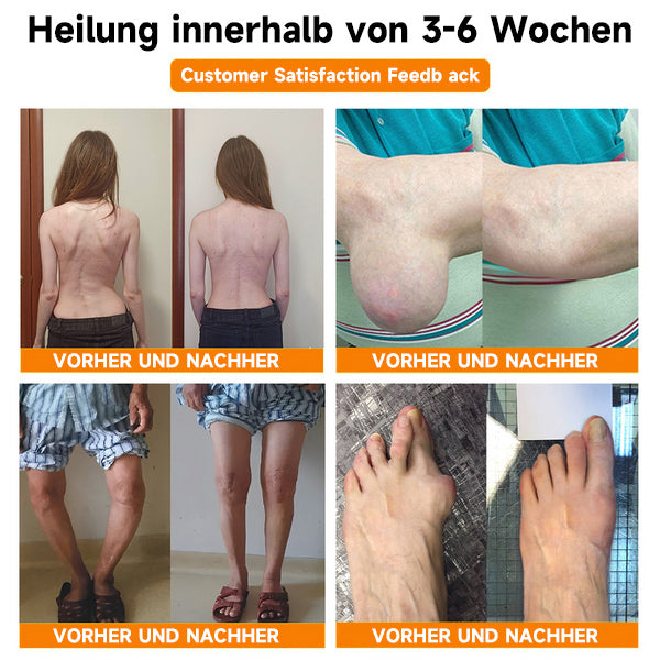 Bienen-Vital-Creme | Rask smertelindring | Skanto