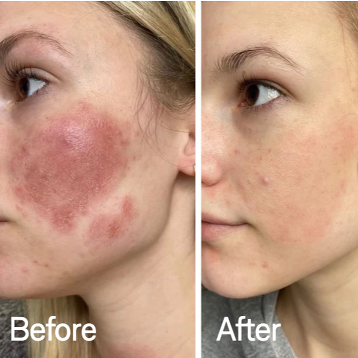 VitaleSkin Maske | Skanto