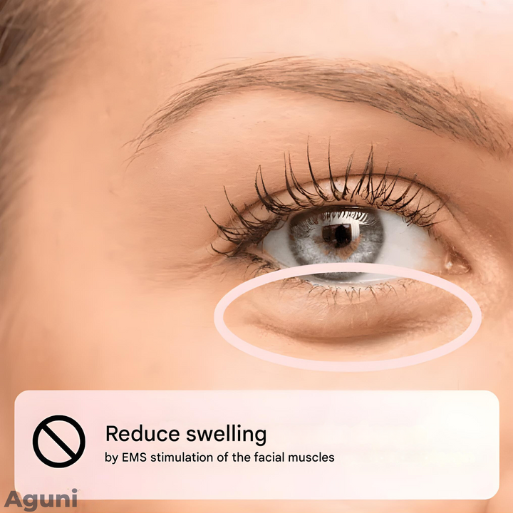 Skanto | EMS Briller - EyeRevive