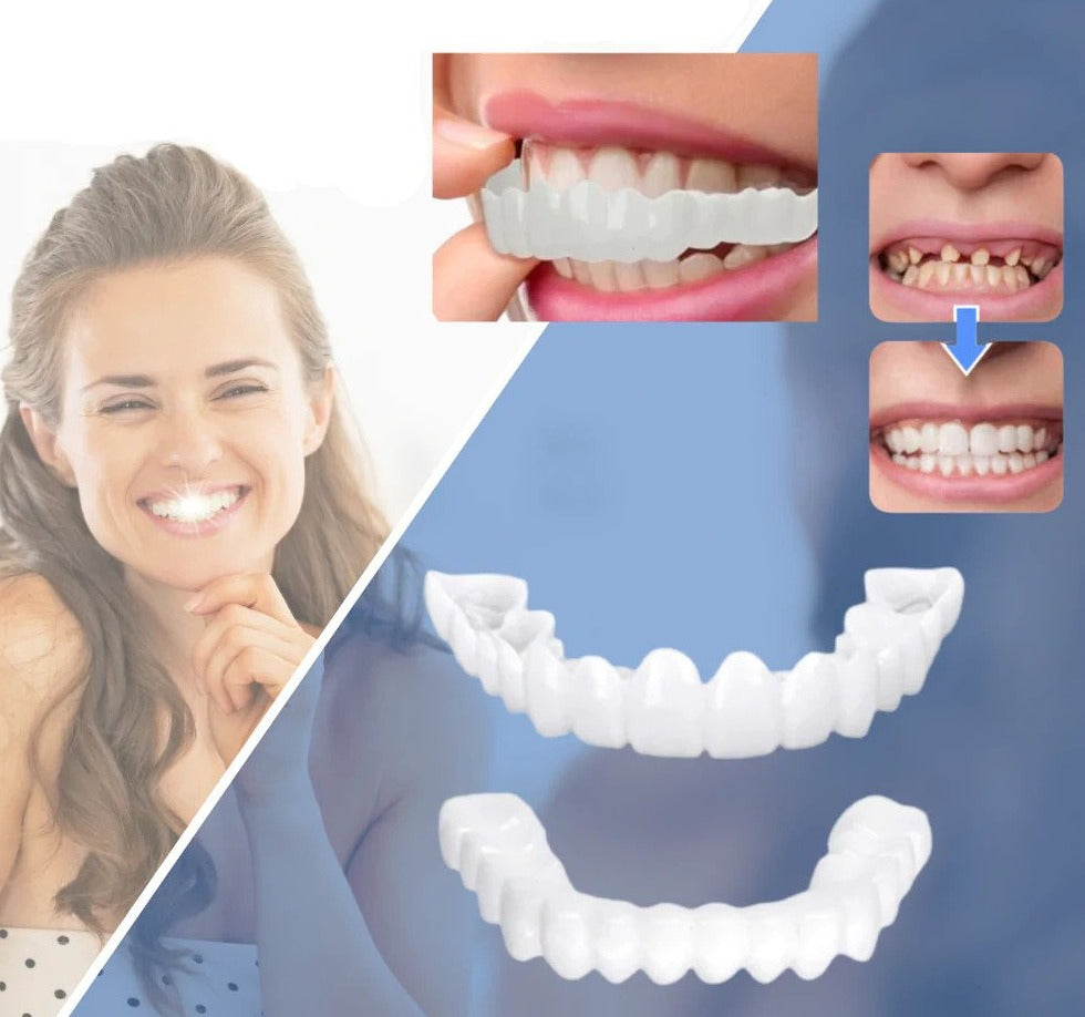 Skanto | Snap-on Teeth™ - Med disse fasettene, ha alltid det perfekte smilet