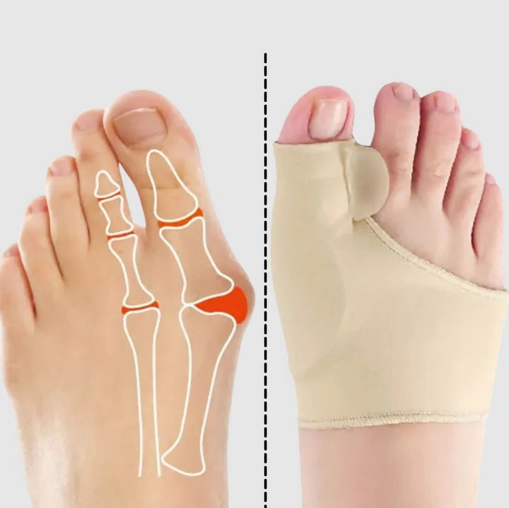 Skanto | Gel bunion korrektor