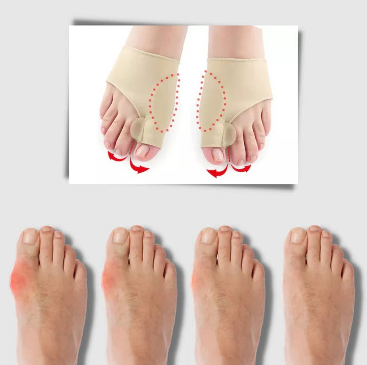 Skanto | Gel bunion korrektor