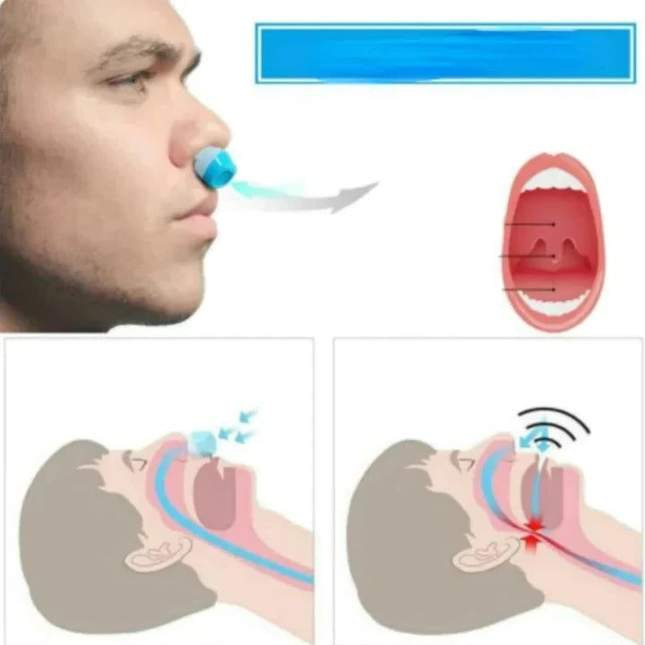 Skanto | 2-i-1 Anti Snore Device og Luftrenser Nese Klem