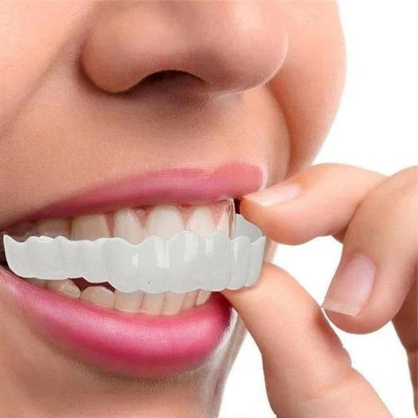 Herausnehmbare Veneers für Ober- und Unterkieferzähne