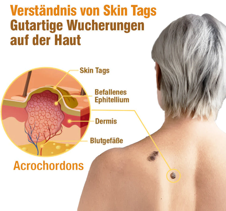 TagRecede Bee Gift Spray | Naturlig Hudperfeksjon | Skanto