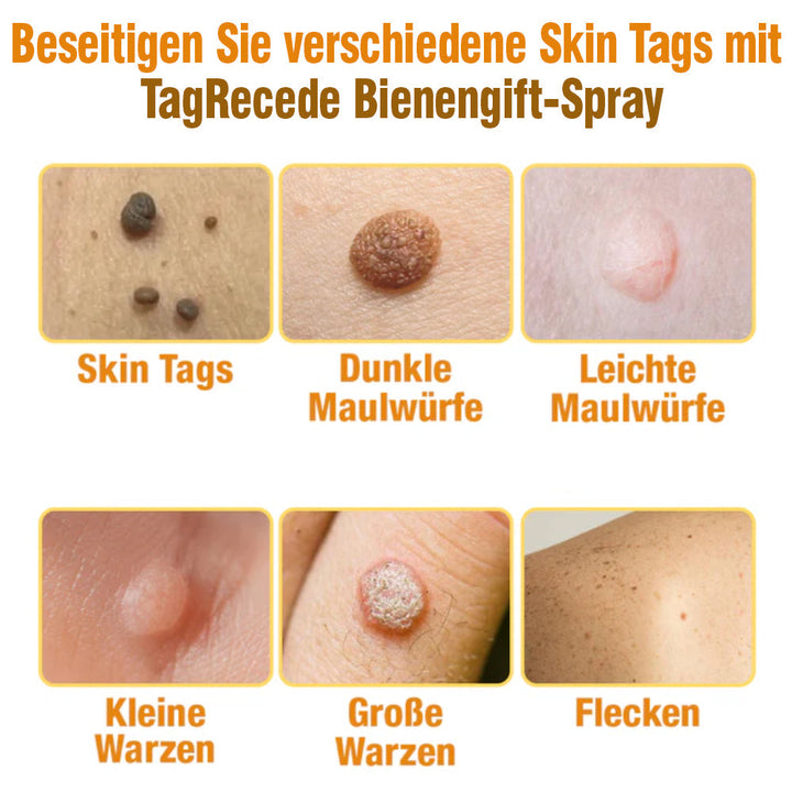 TagRecede Bee Gift Spray | Naturlig Hudperfeksjon | Skanto